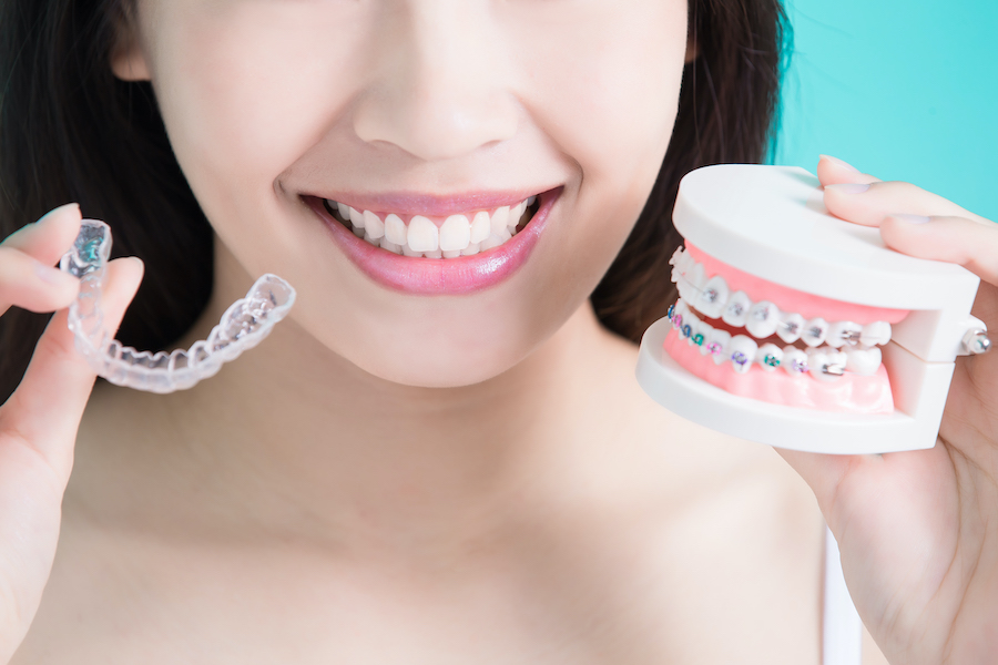 Asian woman smiles as she holds up clear aligners and a teeth model with braces to compare orthodontic treatments
