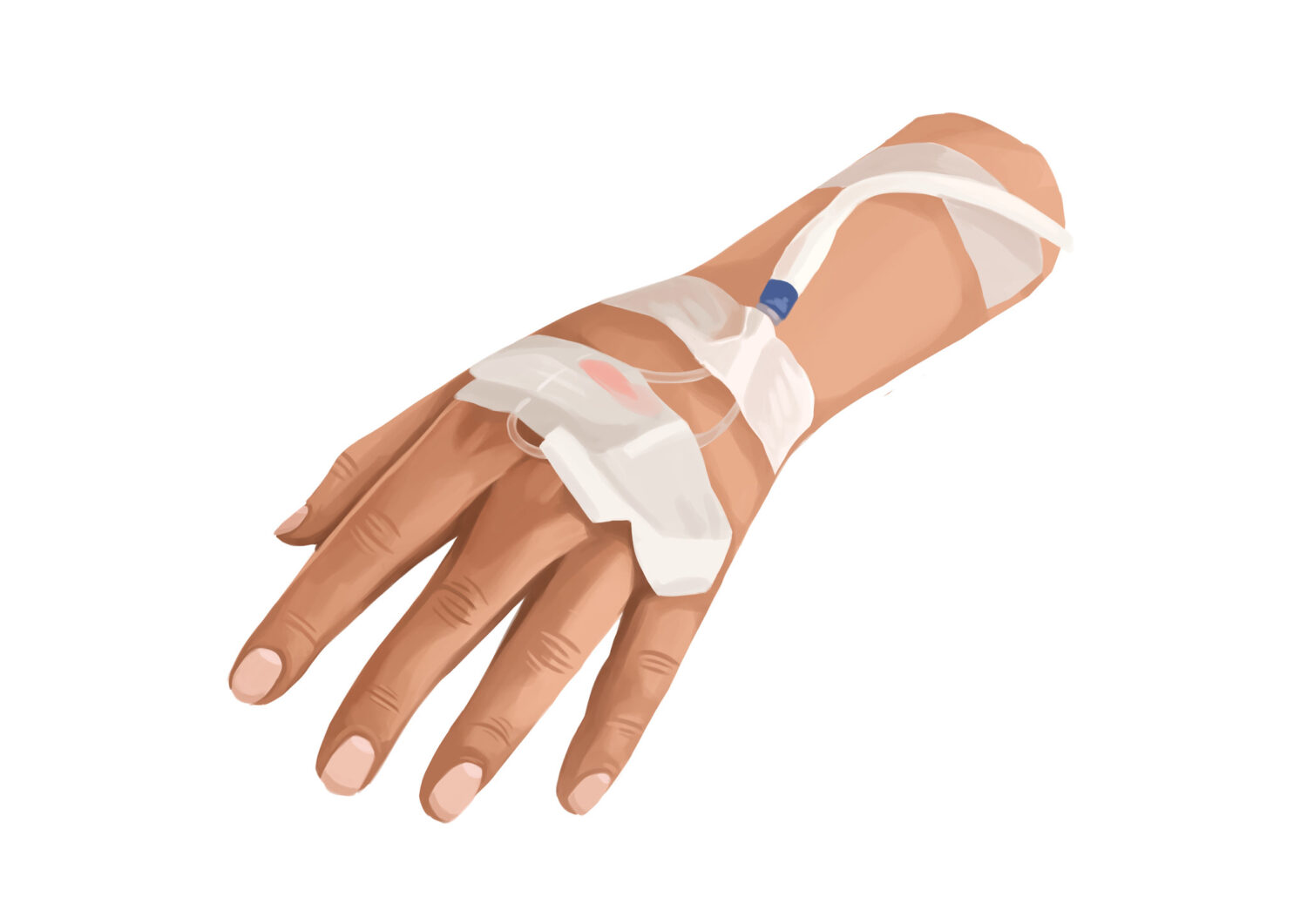 IV sedation option of dental sedation